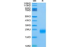 Biotinylated Huma LAIR2 on Tris-Bis PAGE under reduced condition. (LAIR2 Protein (AA 22-152) (His-Avi Tag,Biotin))