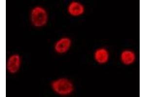 ABIN6274011 staining Hela by IF/ICC. (FUBP1 抗体  (C-Term))