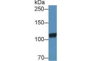 Detection of DPP6 in Porcine Cerebrum lysate using Polyclonal Antibody to Dipeptidyl Peptidase 6 (DPP6)