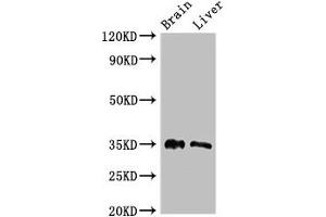 Western Blot Positive WB detected in: Mouse brain tissue, Rat liver tissue All lanes: PTF1A antibody at 2. (PTF1A 抗体  (AA 224-325))