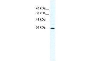Western Blotting (WB) image for anti-Dishevelled Segment Polarity Protein 1 (DVL1) antibody (ABIN2460375) (DVL1 抗体)