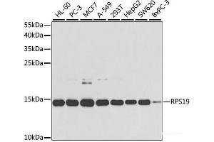 Western blot analysis of extracts of various cell lines using RPS19 Polyclonal Antibody at dilution of 1:1000. (RPS19 抗体)