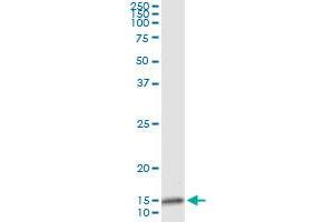 Immunoprecipitation of IL8 transfected lysate using anti-IL8 monoclonal antibody and Protein A Magnetic Bead , and immunoblotted with IL8 MaxPab rabbit polyclonal antibody. (IL-8 抗体  (AA 21-99))