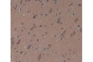 Used in DAB staining on fromalin fixed paraffin- embedded brain tissue (PSMB9 抗体)