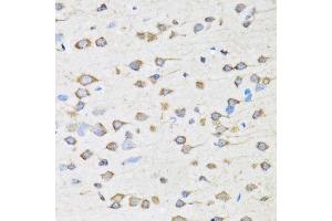 Immunohistochemistry (Paraffin-embedded Sections) (IHC (p)) image for anti-Coatomer Protein Complex, Subunit beta 2 (COPB2) (AA 657-906) antibody (ABIN6138871)