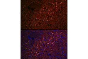 Immunofluorescence analysis of rat brain cells using CEND1 Rabbit mAb (ABIN7266242) at dilution of 1:100 (40x lens). (CEND1 抗体)