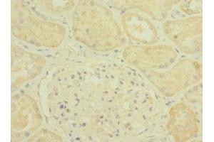 Immunohistochemistry of paraffin-embedded human kidney tissue using ABIN7163708 at dilution of 1:100 (Plexin B2 抗体  (AA 1080-1200))