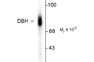 Western blots of human adrenal medulla lysate showing specific immunolabeling of the ~75k DBH protein. (DBH 抗体  (C-Term))