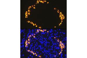 Immunofluorescence analysis of rat pancreas using GLP-1 antibody (ABIN7267392) at dilution of 1:100. (Glucagon 抗体)