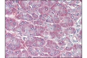 Human Pancreas (formalin-fixed, paraffin-embedded) stained with RBP1followed by biotinylated anti-goat IgG secondary antibody, alkaline phosphatase-streptavidin and chromogen. (RBP1 抗体  (C-Term))