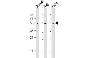 All lanes : Anti-XI Antibody at 1:1000-1:4000 dilution Lane 1: Jurkat whole cell lysates Lane 2: Raji whole cell lysates Lane 3: Hela whole cell lysates Lysates/proteins at 20 μg per lane. (XIAP 抗体)