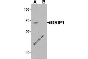 Western Blotting (WB) image for anti-Glutamate Receptor Interacting Protein 1 (GRIP1) (C-Term) antibody (ABIN1077440) (GRIP1 抗体  (C-Term))