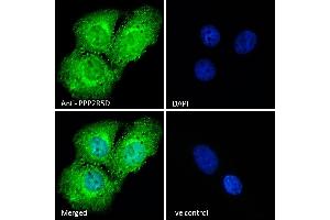 (ABIN184648) Immunofluorescence analysis of paraformaldehyde fixed U2OS cells, permeabilized with 0. (PPP2R5D 抗体  (C-Term))