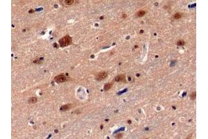 Detection of PSMC3 in Human Cerebrum Tissue using Polyclonal Antibody to Proteasome 26S Subunit, ATPase 3 (PSMC3) (PSMC3 抗体  (AA 2-439))