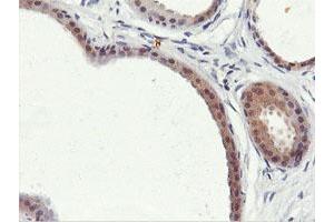 Immunohistochemical staining of paraffin-embedded Human breast tissue using anti-PNPO mouse monoclonal antibody. (PNPO 抗体)