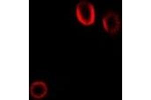 Immunofluorescent analysis of Colipase staining in Hela cells. (CLPS 抗体)