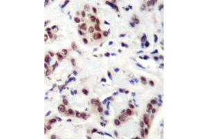 Immunohistochemistry (IHC) image for anti-Signal Transducer and Activator of Transcription 5A (STAT5A) (pTyr694) antibody (ABIN1870647) (STAT5A 抗体  (pTyr694))
