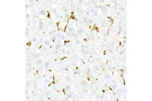 Immunohistochemistry of paraffin-embedded Human liver using CD74 antibody (ABIN6128421, ABIN6138228, ABIN6138230 and ABIN6221316) at dilution of 1:25 (40x lens). (CD74 抗体  (AA 73-232))