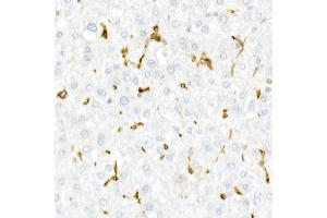 Immunohistochemistry of paraffin-embedded Human liver using CD74 antibody (ABIN6128421, ABIN6138228, ABIN6138230 and ABIN6221316) at dilution of 1:25 (40x lens). (CD74 抗体  (AA 73-232))