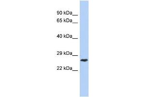 WB Suggested Anti-DIRAS1 Antibody Titration: 0. (DIRAS1 抗体  (Middle Region))