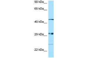 WB Suggested Anti-NPAL3 Antibody Titration: 1. (NIPAL3 抗体  (N-Term))