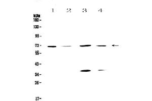 Western blot analysis of DNA Polymerase lambda using anti-DNA Polymerase lambda antibody . (POLL 抗体  (AA 307-407))
