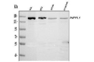Western blot analysis of INPPL1 using anti-INPPL1 antibody (ABIN6719492). (INPPL1 抗体  (AA 1172-1258))