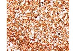 Formalin-fixed, paraffin-embedded human tonsil stained with CD79 antibody (SPM549).