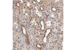 Immunohistochemical staining of human kidney with ZNF75A polyclonal antibody  shows moderate cytoplasmic and nuclear positivity in cells in tubules at 1:50-1:200 dilution. (ZNF75A 抗体)
