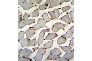 Formalin fixed and paraffin embedded human skeletal muscle reacted with DDX60L Antibody (C-term) followed by peroxidase conjugation of the secondary antibody and DAB staining. (DDX60L 抗体  (C-Term))