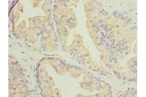 Immunohistochemistry (IHC) image for anti-Dynein, Axonemal, Light Intermediate Chain 1 (DNALI1) (AA 1-258) antibody (ABIN7145131)