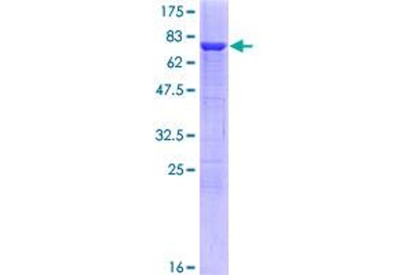 Tryptophan Hydroxylase 1 Protein (TPH1) (AA 1-444) (GST tag)