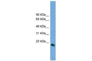 WB Suggested Anti-IFNB1 Antibody Titration:  0. (IFNB1 抗体  (Middle Region))
