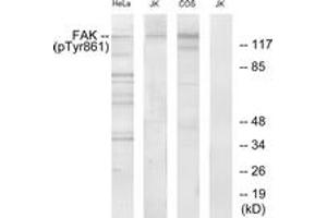 Western blot analysis of extracts from HeLa cells, Jurkat cells and COS cells, using FAK (Phospho-Tyr861) Antibody. (FAK 抗体  (pTyr861))