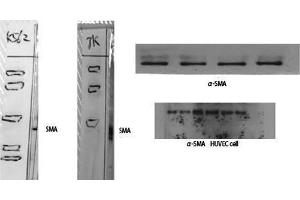 Western Blotting (WB) image for anti-alpha-SMA (N-Term) antibody (ABIN3180968) (alpha-SMA (N-Term) 抗体)