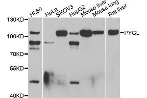 Western blot analysis of extracts of various cell lines, using PYGL antibody (ABIN5974053) at 1/1000 dilution. (PYGL 抗体)