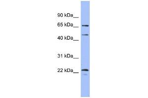 WB Suggested Anti-MAPK4 Antibody Titration: 0. (MAPK4 抗体  (Middle Region))