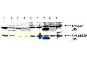 Image no. 2 for anti-Nuclear Factor-kB p65 (NFkBP65) (pSer276) antibody (ABIN1103942) (NF-kB p65 抗体  (pSer276))