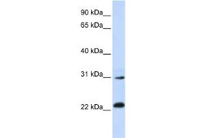 WB Suggested Anti-AP3S1 Antibody Titration: 0. (AP3S1 抗体  (N-Term))