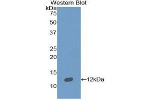 Western Blotting (WB) image for anti-Sema Domain, Immunoglobulin Domain (Ig), Short Basic Domain, Secreted, (Semaphorin) 3E (SEMA3E) (AA 651-740) antibody (ABIN1860520) (SEMA3E 抗体  (AA 651-740))