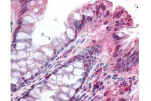 affinity purified anti-NOXO1 antibody was used at 5 ug/ml to detect signal in a variety of tissues including multi-human, multi-brain and multi-cancer slides. (NOXO1 抗体  (AA 238-252))