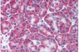 Immunohistochemistry (IHC) image for anti-Potassium Intermediate/small Conductance Calcium-Activated Channel, Subfamily N, Member 4 (KCNN4) (N-Term) antibody (ABIN1048992)