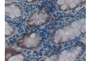 Used in DAB staining on fromalin fixed paraffin- embedded kidney tissue (Glucocorticoid Receptor 抗体  (AA 41-184))