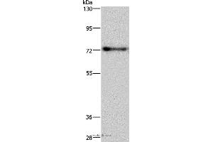 Western blot analysis of Mouse brain tissue, using PATZ1 Polyclonal Antibody at dilution of 1:250 (PATZ1 抗体)