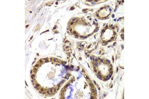 Immunohistochemistry of paraffin-embedded Human mammary gland using HDAC4 antibody at dilution of 1:100 (x40 lens). (HDAC4 抗体)