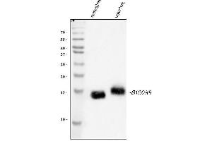 Western blot analysis of S100A9 using anti-S100A9 antibody (ABIN3042482). (S100A9 抗体  (AA 2-113))