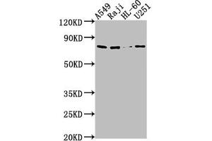 Western Blot Positive WB detected in: A549 whole cell lysate, Raji whole cell lysate, HL60 whole cell lysate, U251 whole cell lysate All lanes: RANBP9 antibody at 1:1000 Secondary Goat polyclonal to rabbit IgG at 1/50000 dilution Predicted band size: 78, 44, 56 kDa Observed band size: 78 kDa (Importin 9 抗体  (AA 158-176))