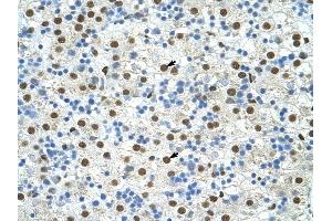 EXOSC4 antibody was used for immunohistochemistry at a concentration of 4-8 ug/ml to stain Hepatocytes (arrows) in Human Liver. (EXOSC4 抗体  (N-Term))