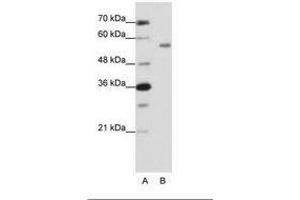 Image no. 1 for anti-Zinc Finger Protein 497 (ZNF497) (N-Term) antibody (ABIN202666) (ZNF497 抗体  (N-Term))