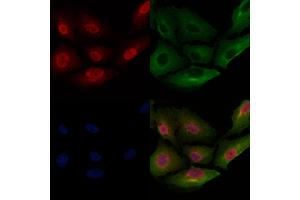 ABIN6257139 and ABIN6275758 staining  cells by IF/ICC.